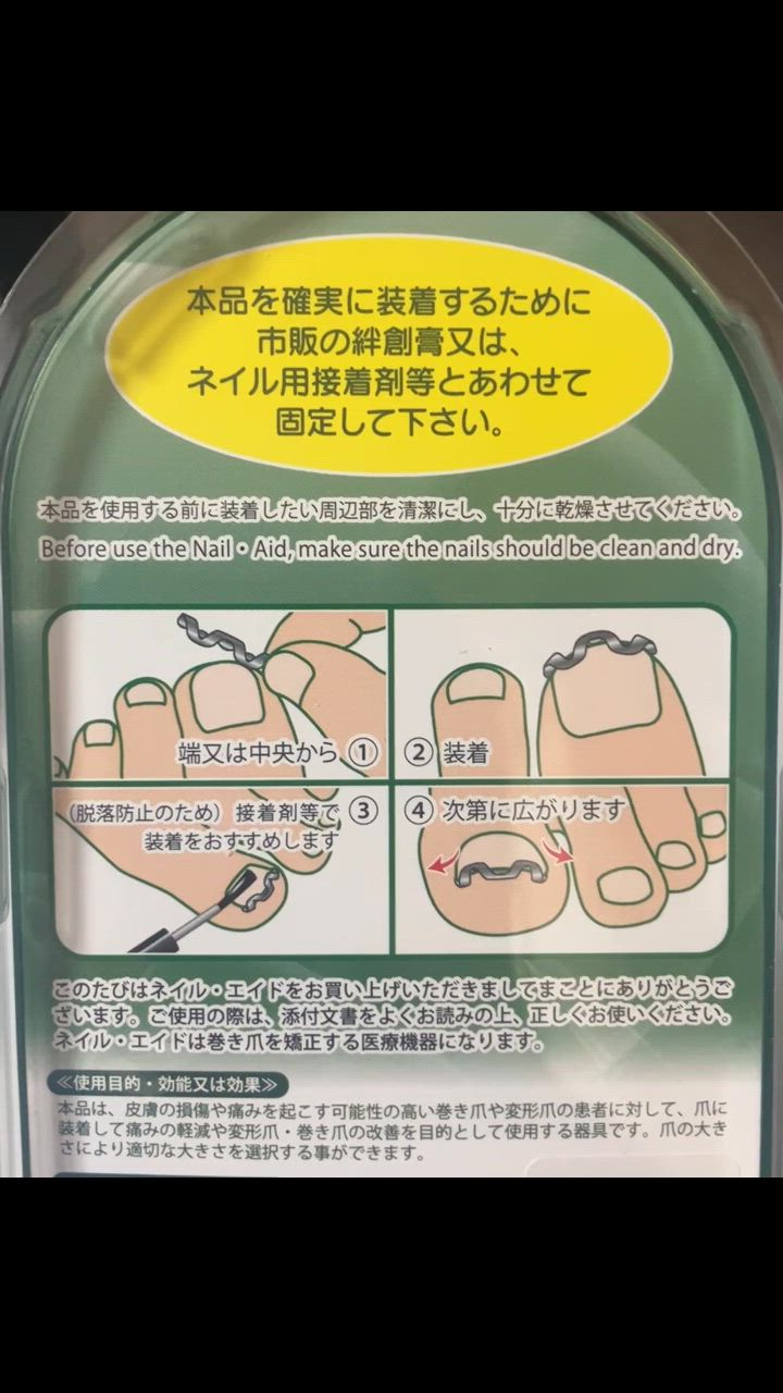 巻き爪治療 巻き爪矯正 自分で ネイルエイド 16mm ワイヤー
