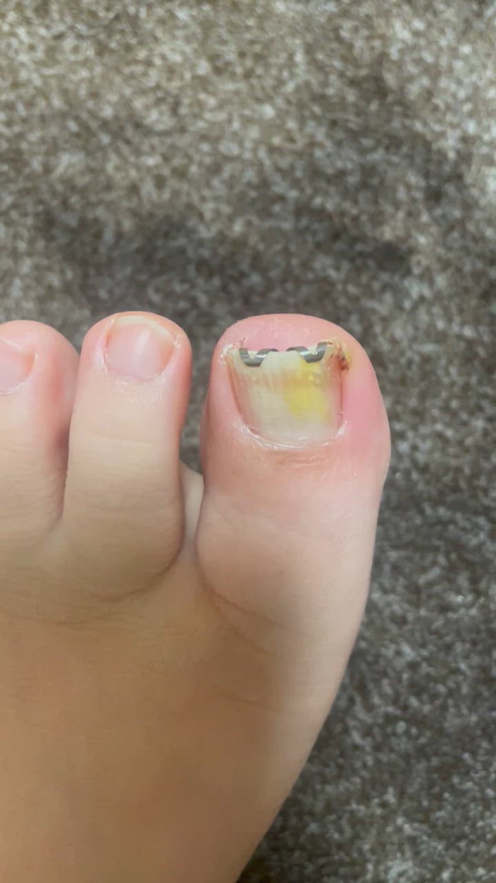 全体のレビュー動画のサムネイル | 3