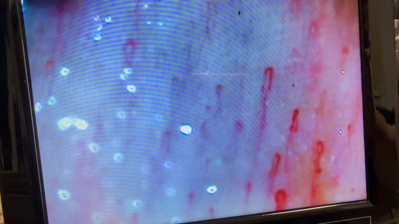 観察 血流スコープ◇毛細血管 顕微鏡 880+600倍+8インチ画面を