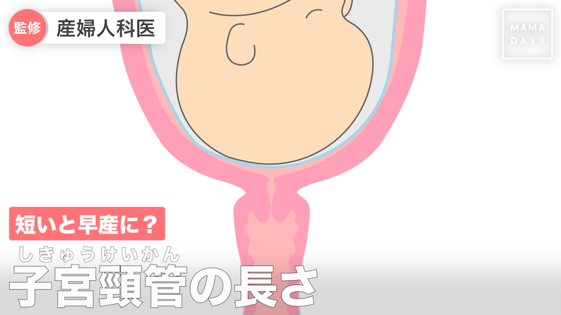短いと早産に 子宮頸管 しきゅうけいかん の長さ Mamadays ママデイズ Yahoo Japan